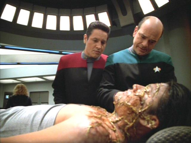 The Doctor treats Ensign Kim with nanoprobes